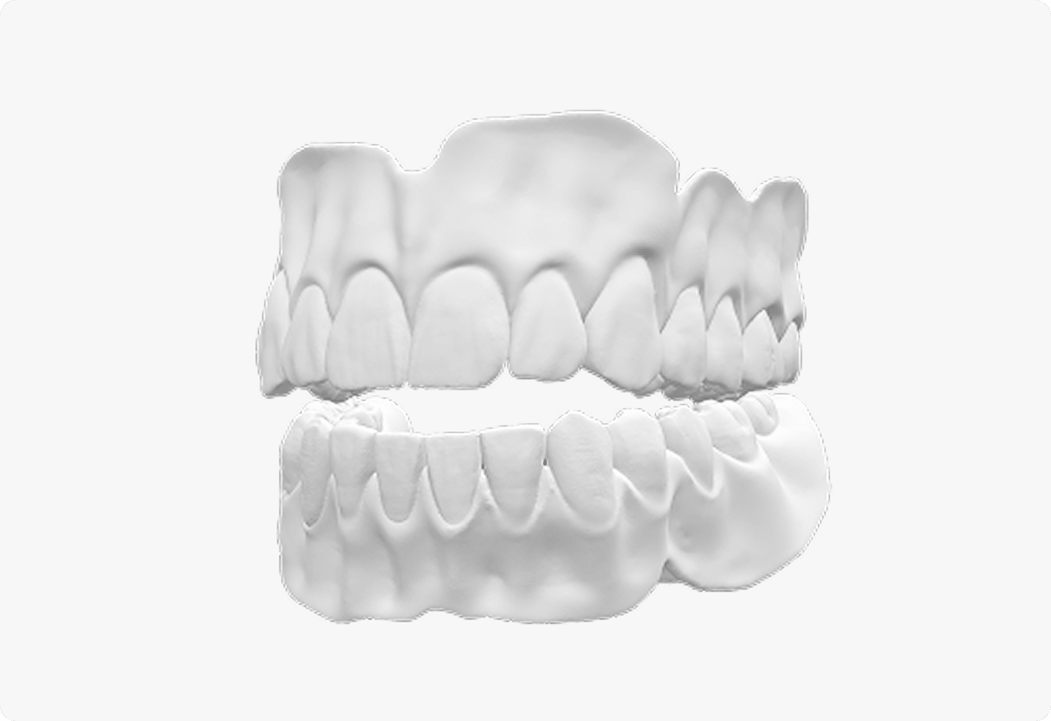 Denture